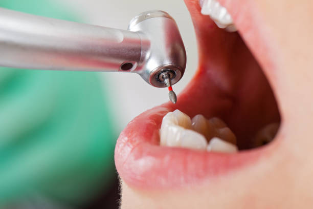 Best Emergency Dental Surgery in Irondale, GA